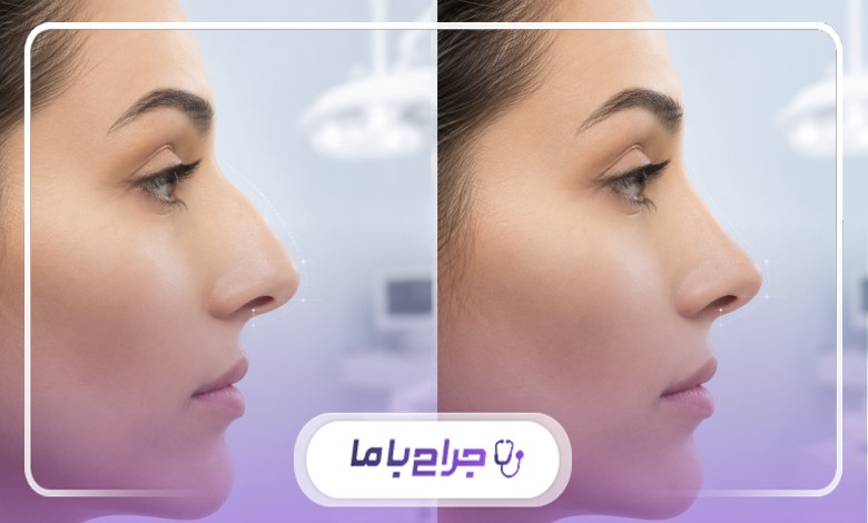 قبل از انتخاب جراح بینی چه سوالاتی بپرسیم؟