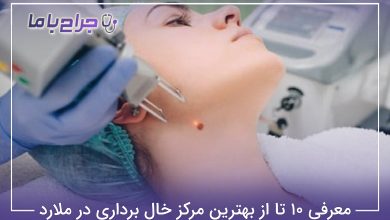 بهترین مرکز خال برداری در ملارد