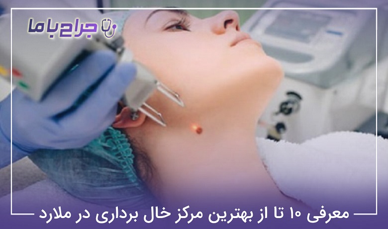 بهترین مرکز خال برداری در ملارد