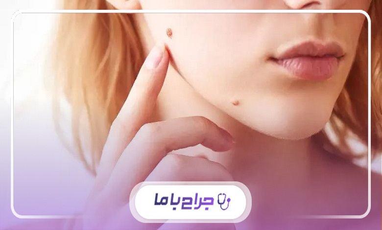 کدام مرکز خال برداری در ملارد برای شما مناسب است؟
