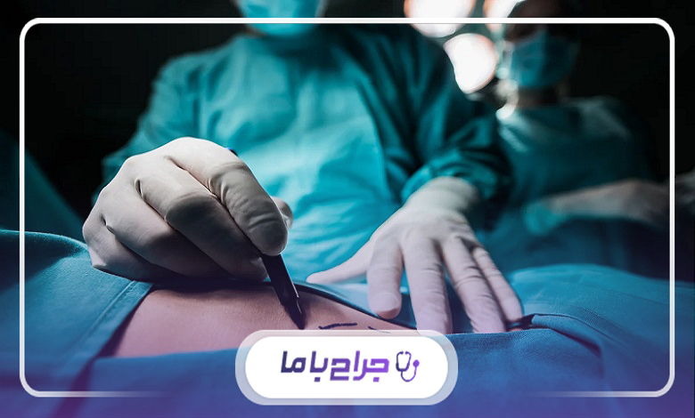 دستورالعملهای بعد از جراحی سینه برای نتیجه بهتر