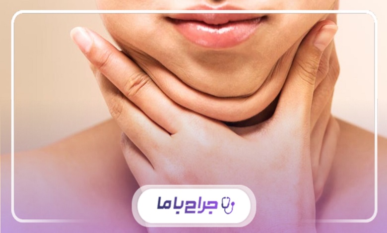 چگونه بهترین دکتر ساکشن غبغب در عبدل آباد را پیدا کنیم؟