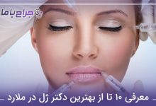 بهترین دکتر ژل در ملارد