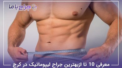 بهترین جراح لیپوماتیک در کرج