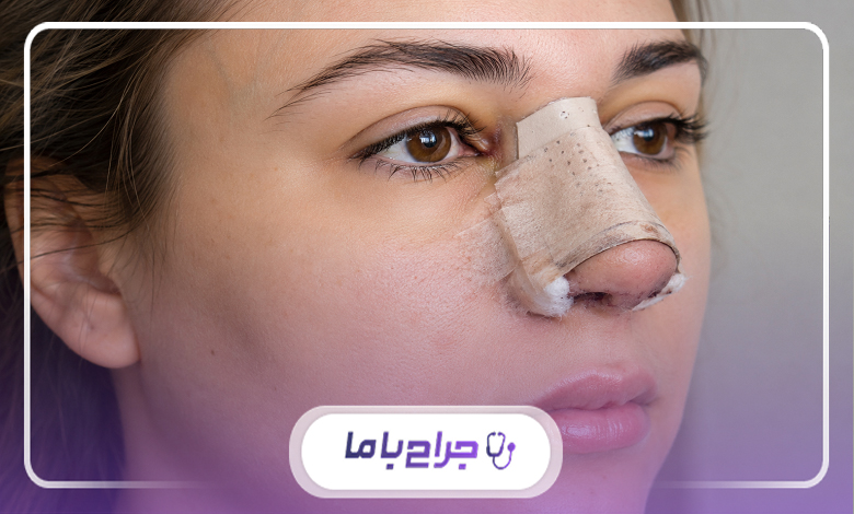 مراحل مشاوره با دکتر بینی در کرج