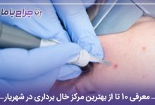 بهترین مرکز خال برداری در شهریار