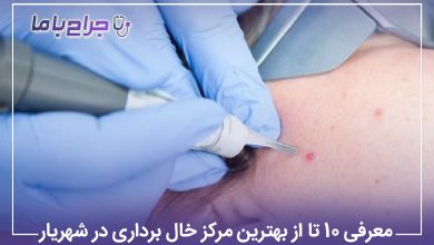 بهترین مرکز خال برداری در شهریار