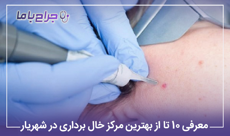 بهترین مرکز خال برداری در شهریار