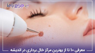 معرفی۱۰ تا از بهترین مرکز خال برداری در اندیشه【سال1405】❤️