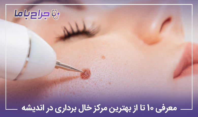 معرفی۱۰ تا از بهترین مرکز خال برداری در اندیشه【سال1405】❤️