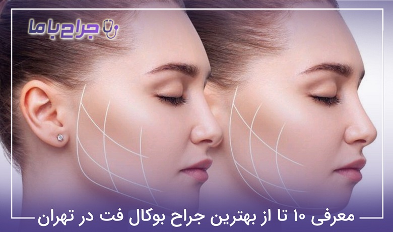 بهترین جراح بوکال فت در تهران