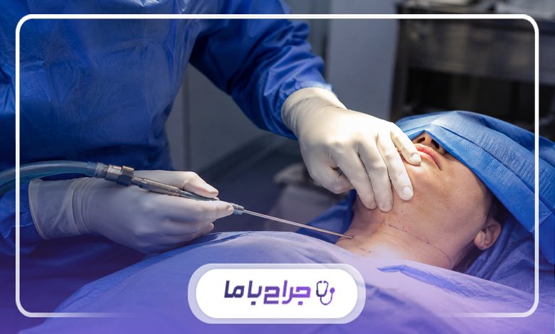 ویژگیهای بهترین دکتر ساکشن غبغب در علی آباد