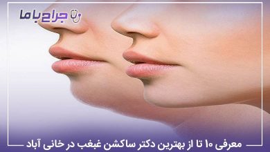 معرفی 10 تا از بهترین دکتر ساکشن غبغب در خانی آباد【سال1405】❤️