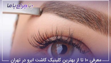 بهترین کلینیک کاشت ابرو در تهران