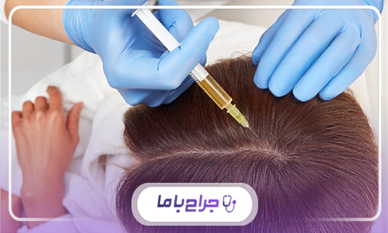 بهترین دکتر مزوتراپی در شهرری