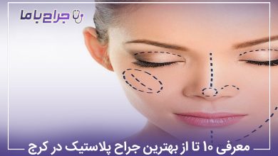 معرفی 10 تا از بهترین جراح پلاستیک در کرج【سال1405】❤️