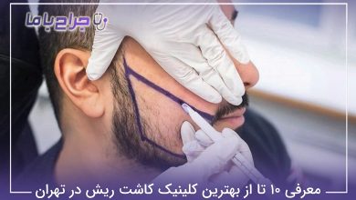 بهترین کلینیک کاشت ریش در تهران