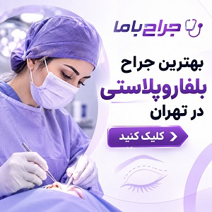 راهنمای انتخاب بهترین جراح بلفاروپلاستی در ایران + لیست جراحان برتر