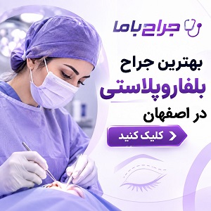 راهنمای انتخاب بهترین جراح بلفاروپلاستی در ایران + لیست جراحان برتر