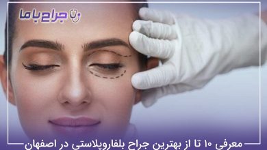 بهترین جراح بلفاروپلاستی در اصفهان