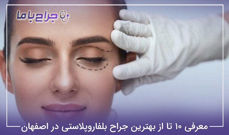بهترین جراح بلفاروپلاستی در اصفهان
