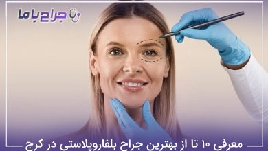 بهترین جراح بلفاروپلاستی در کرج