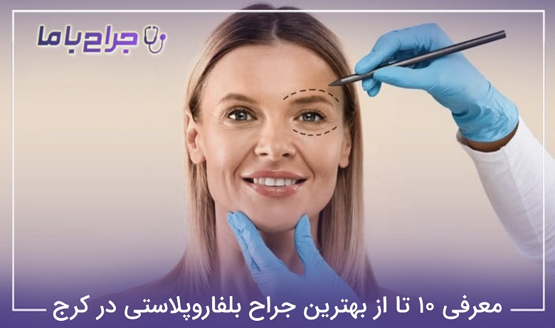 بهترین جراح بلفاروپلاستی در کرج