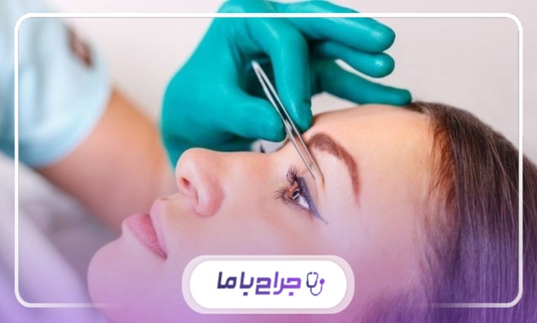 راهنمای انتخاب بهترین جراح بلفاروپلاستی در کرج