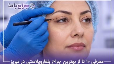 بهترین جراح بلفاروپلاستی در تبریز