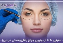 بهترین جراح بلفاروپلاستی در تبریز