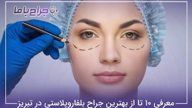 بهترین جراح بلفاروپلاستی در تبریز