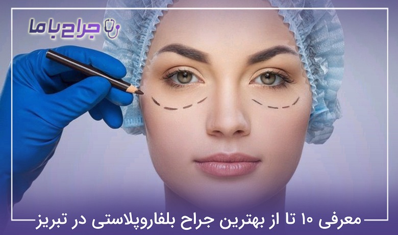 بهترین جراح بلفاروپلاستی در تبریز