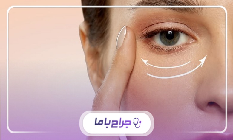 عوارض احتمالی بلفاروپلاستی و راههای پیشگیری از آن