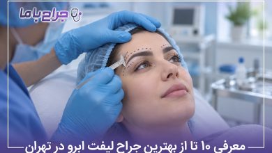بهترین جراح لیفت ابرو در تهران