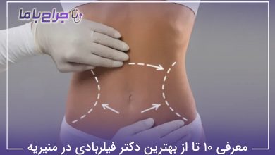 بهترین دکتر فیلربادی در منیریه
