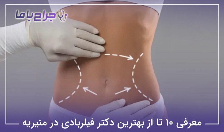 بهترین دکتر فیلربادی در منیریه