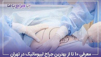 معرفی10 تا از بهترین جراح لیپوماتیک در تهران❤️【آپدیتسال1405】