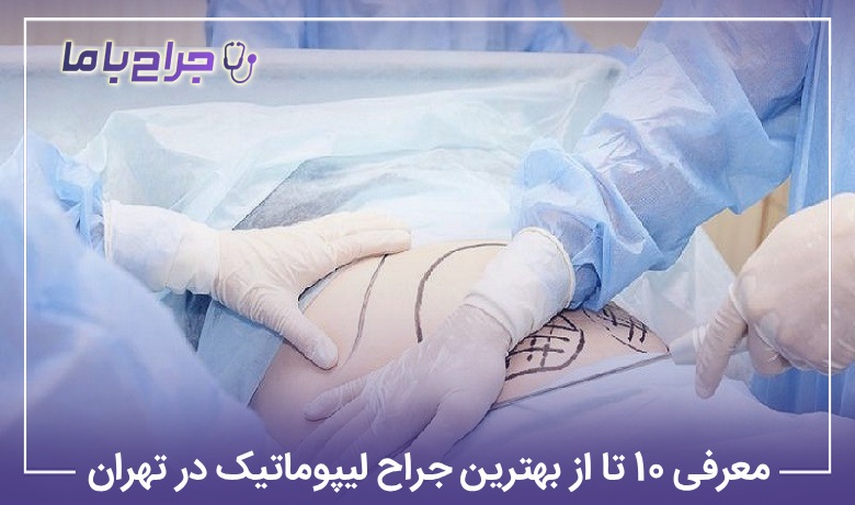 معرفی10 تا از بهترین جراح لیپوماتیک در تهران❤️【آپدیتسال1405】