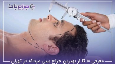 بهترین جراح بینی مردانه در تهران