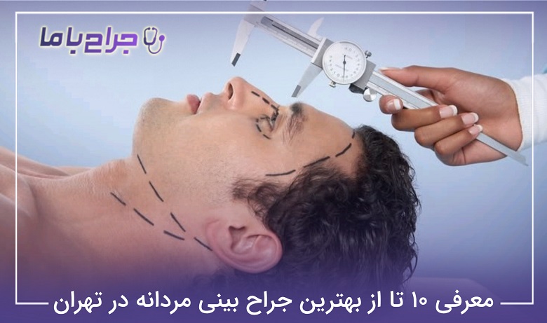 بهترین جراح بینی مردانه در تهران