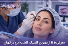 معرفی10 تا از بهترین کلینیک کاشت ابرو در تهران