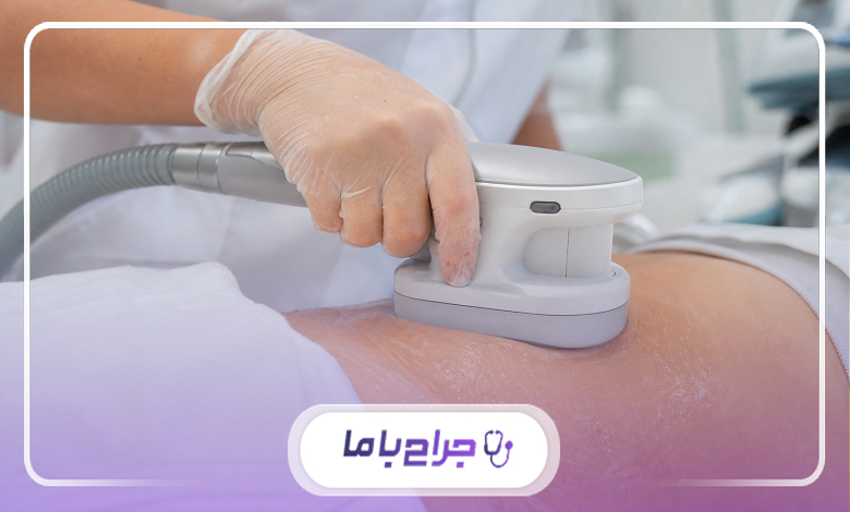 چه افرادی کاندیدای مناسبی برای استفاده از خدمات لاغری هستند؟