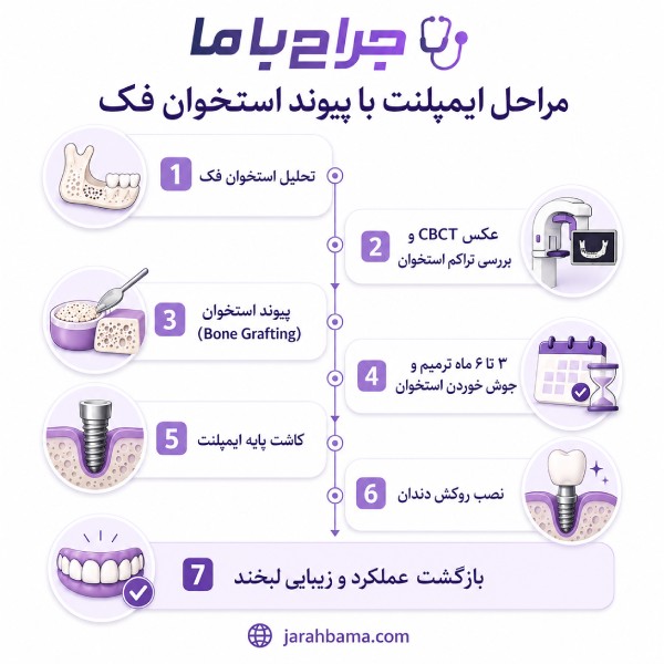 راهنمای کامل انتخاب بهترین دکتر ایمپلنت با پیوند استخوان در تهران