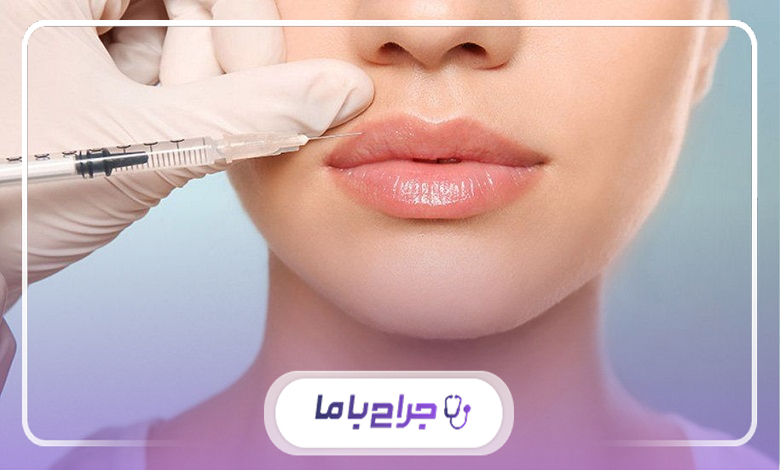 تغییرات قابل انتظار پس از تزریق فیلر