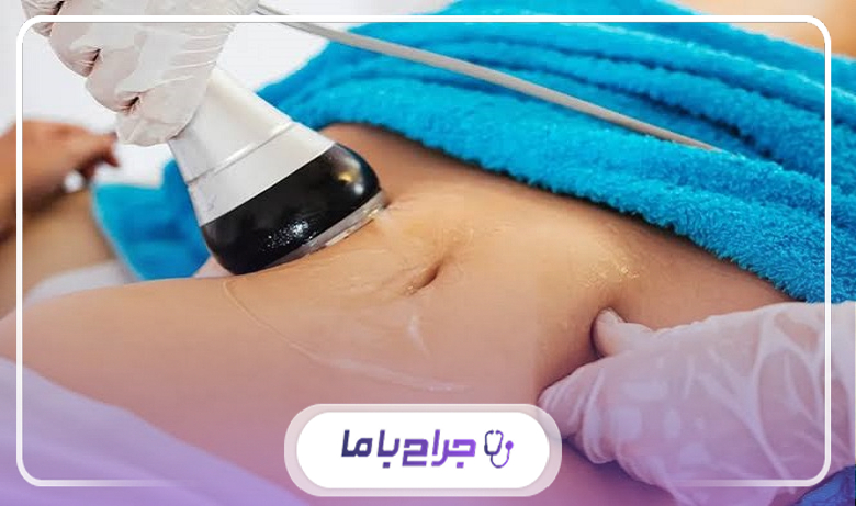 محدودیت استفاده از دستگاههای لاغری