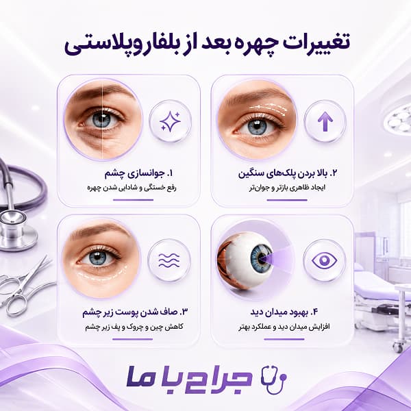 کاندیدای مناسب برای جراحی بلفاروپلاستی