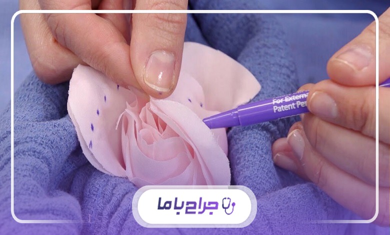 نکات مهم انتخاب جراح متخصص زیبایی زنان در تهران