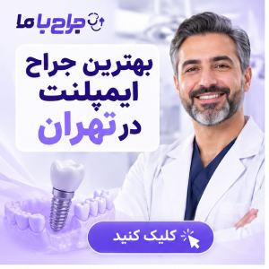 راهنمای انتخاب بهترین متخصص ایمپلنت در اصفهان
