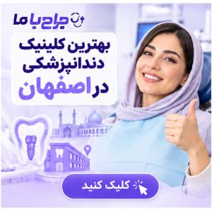 راهنمای انتخاب بهترین متخصص ایمپلنت در اصفهان