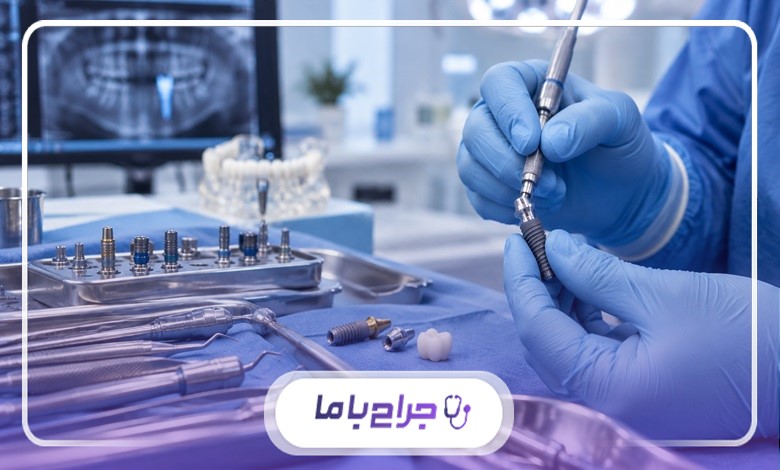 انواع خدمات بهترین دکتر متخصص ایمپلنت در اصفهان